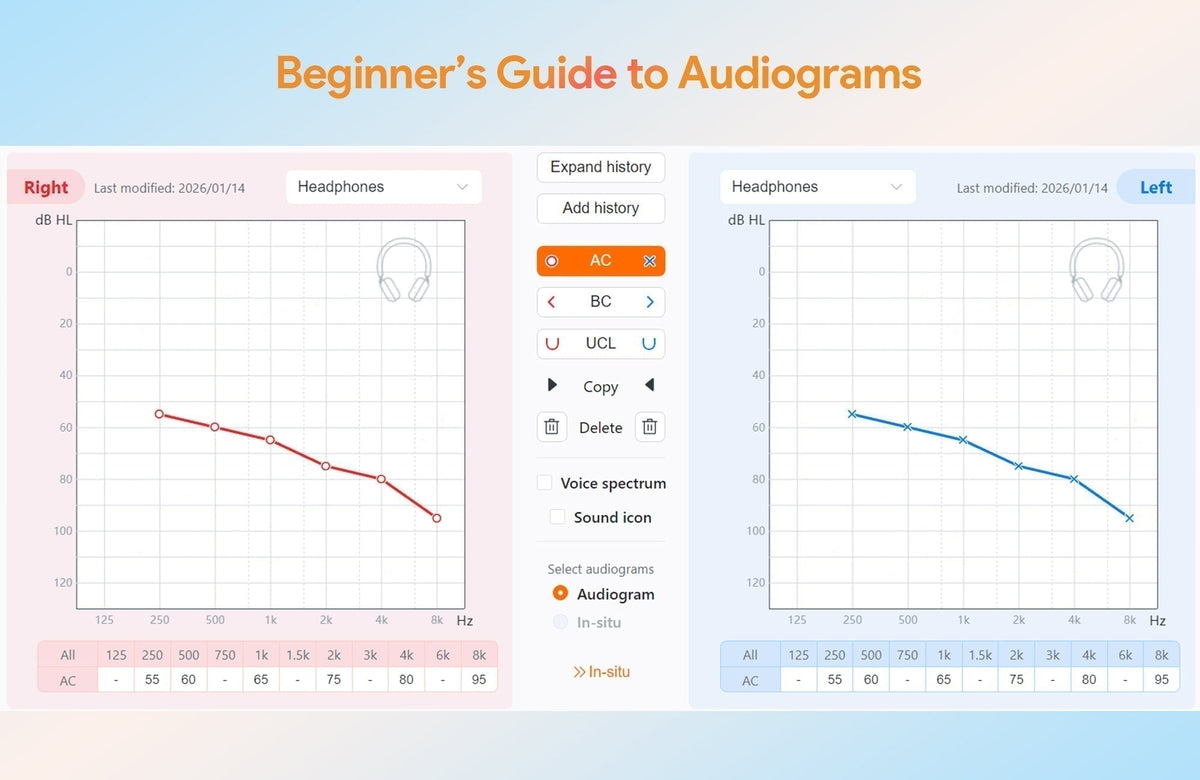 How to Read an Audiogram: A Simple Guide for Beginners