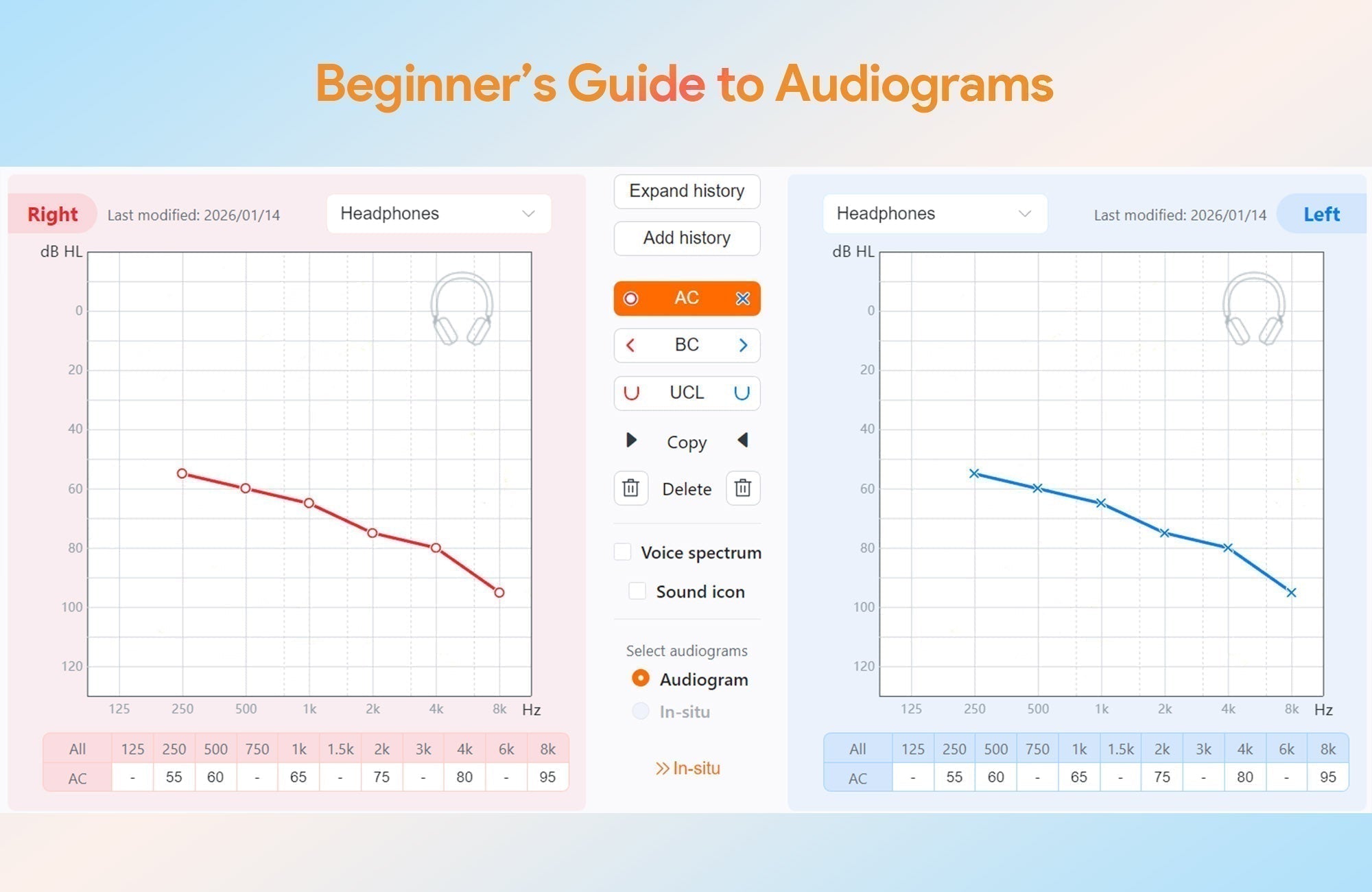 How to Read an Audiogram: A Simple Guide for Beginners