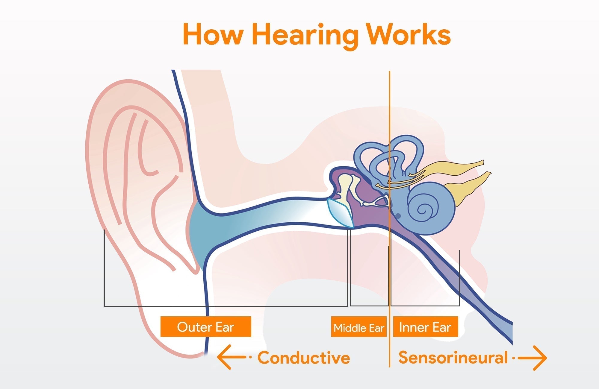The Three Main Types of Hearing Loss